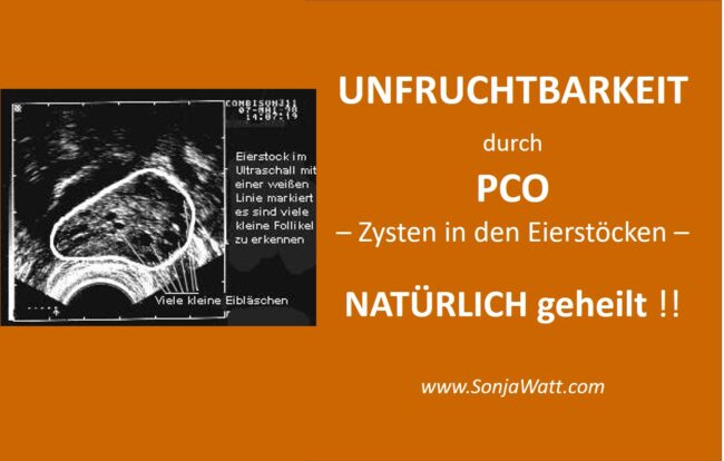 PCO, Zysten, Zysten in Eierstöcken, Unfruchtbarkeit, ich kann keine Kinder kriegen, Sonja Watt
